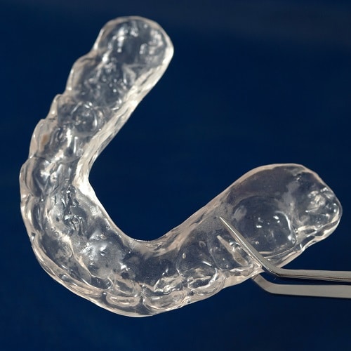 Choice Dental Dental splint to prevent bruxism