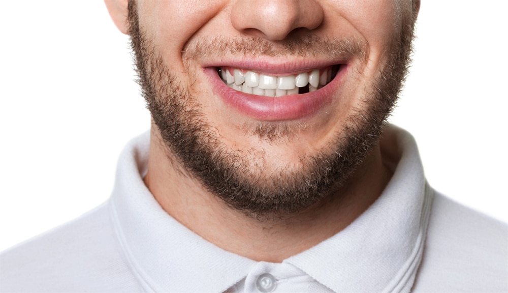 Dental Implants – the permanent solution to missing teeth
