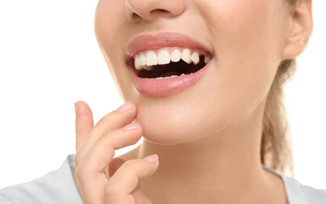 Does your smile have a missing tooth?