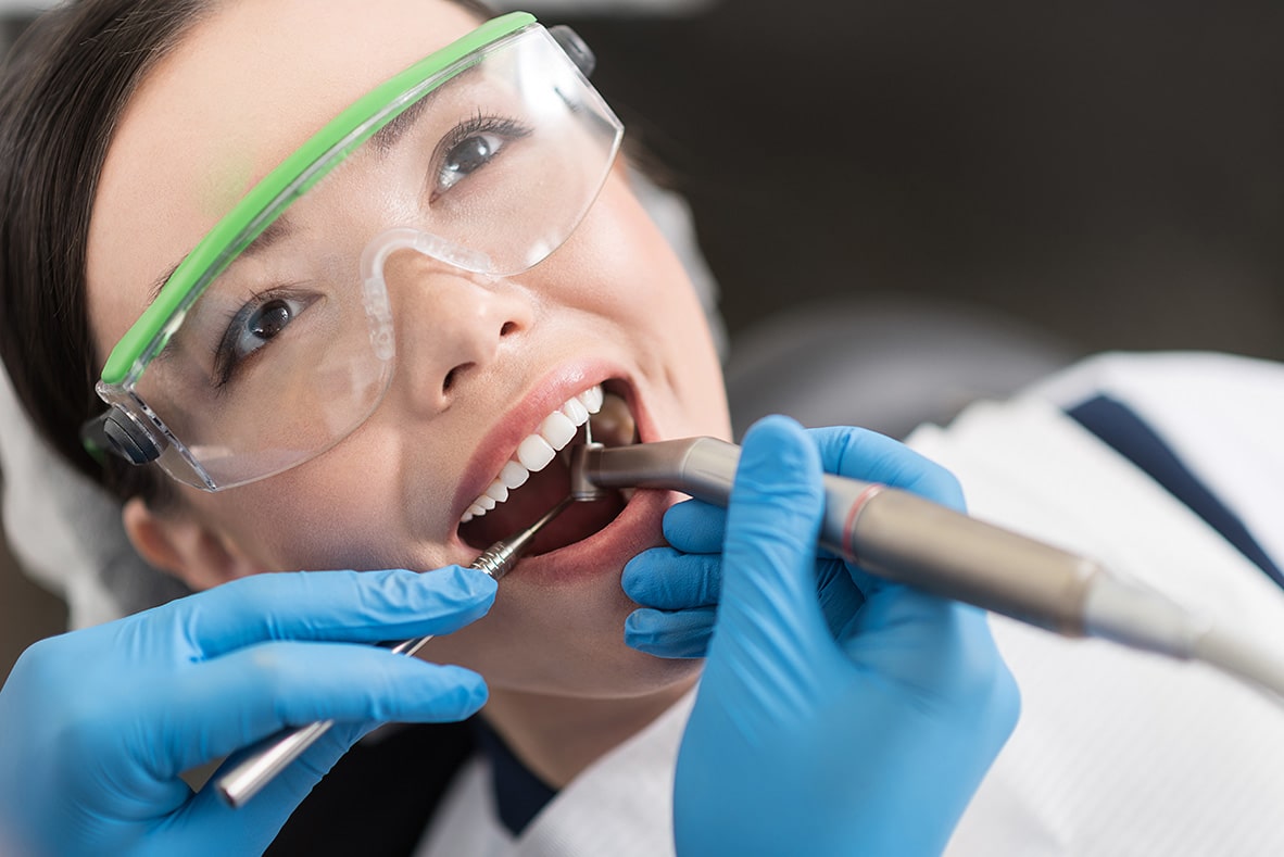 Choice-dental-inlay-onlay-Browns-plains