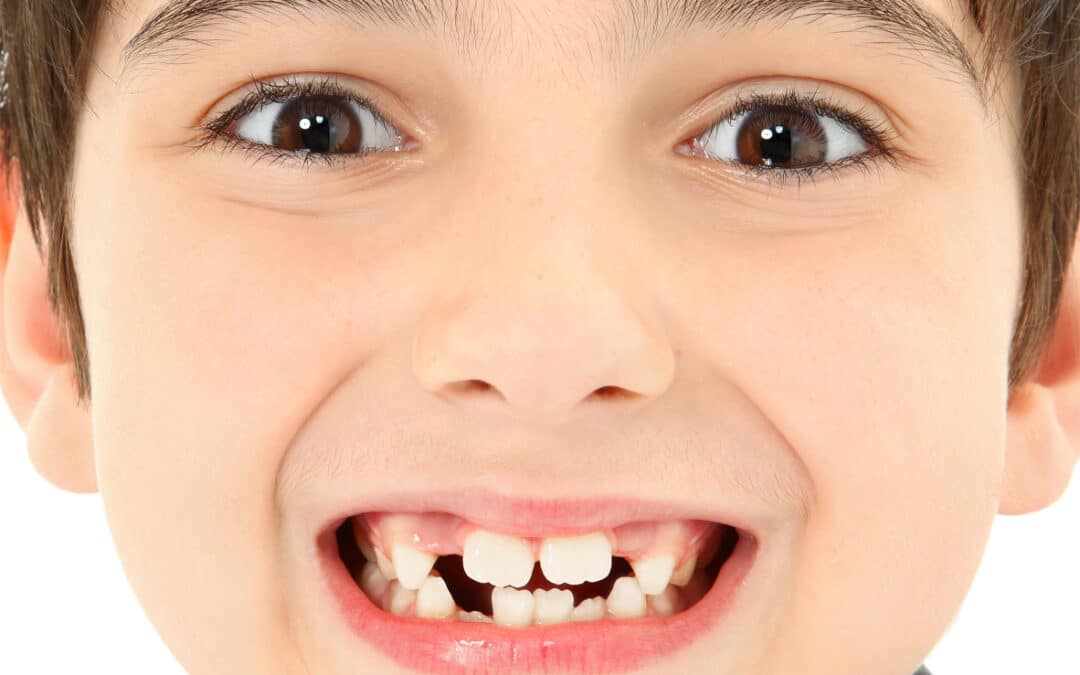 Ensuring your child develops healthy teeth for life