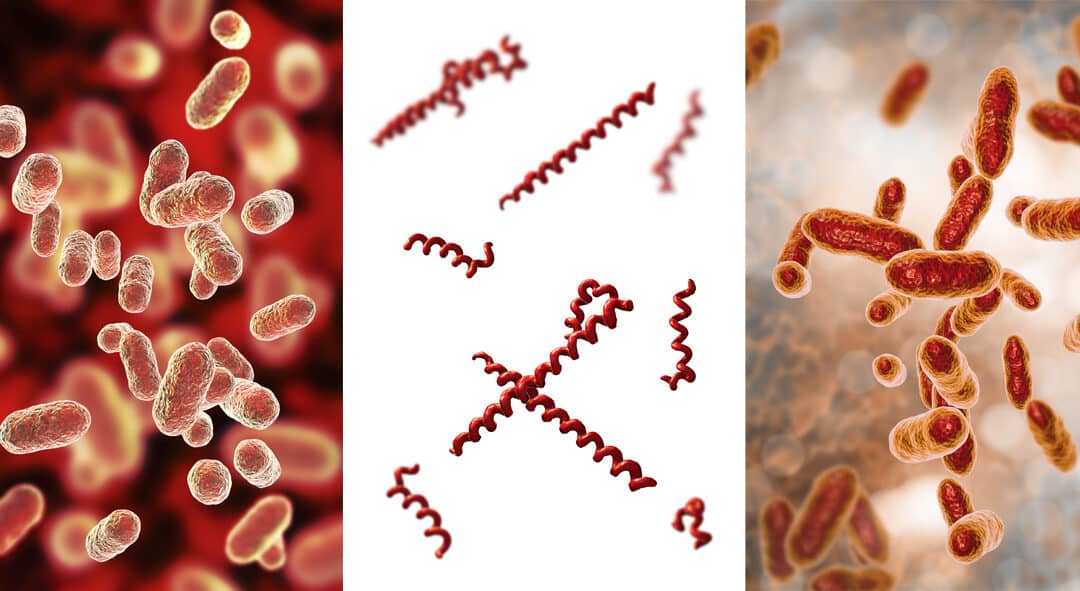 Browns-Plains-pathogenic-oral-bacteria-DNA-test