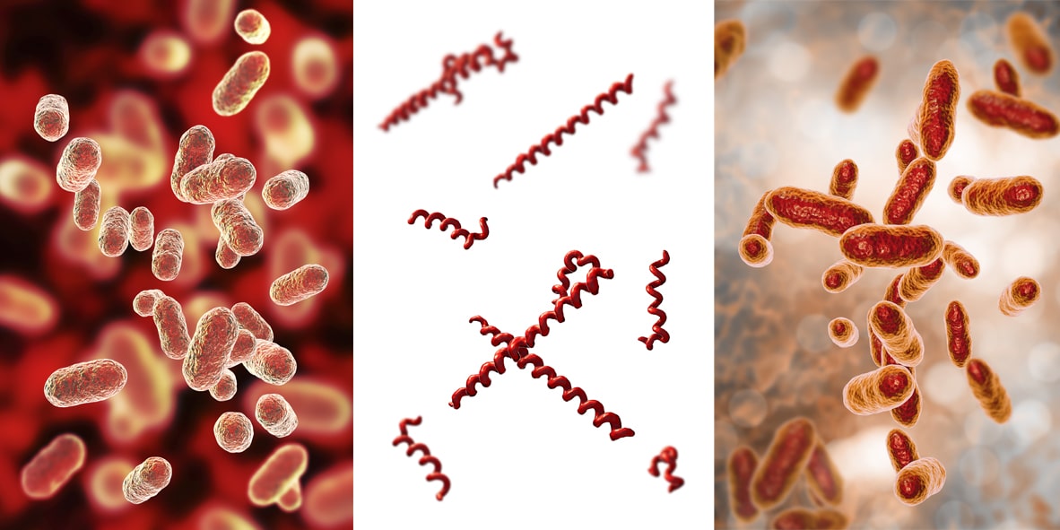 The oral bacteria that can crawl into your brain