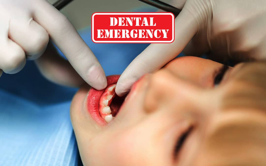 Dental Emergencies for kids 3-10 yrs