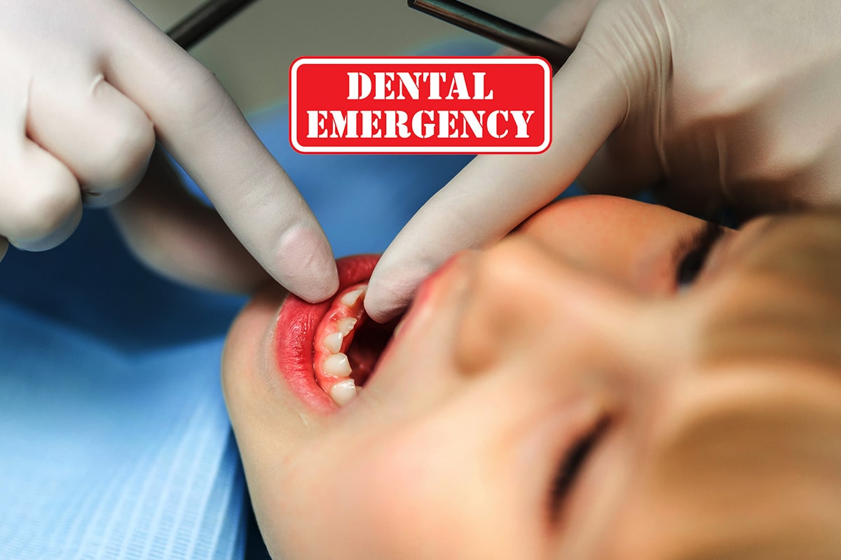 Dental Emergencies for kids 3-10 yrs
