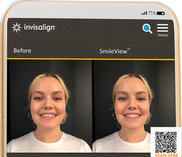 Browns-Plains-Invisalign-Smile-View-Simulator