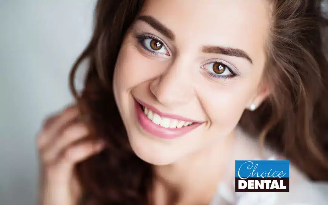 Choice-dental-veneers-treatment-Brisbane-1080×675.jpg
