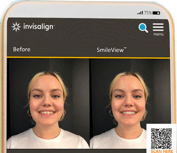 invi-lpi-phone-mock