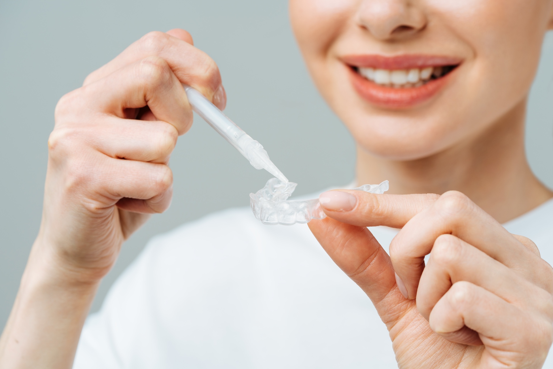 A young woman does a home teeth whitening procedure. Whitening tray with gel