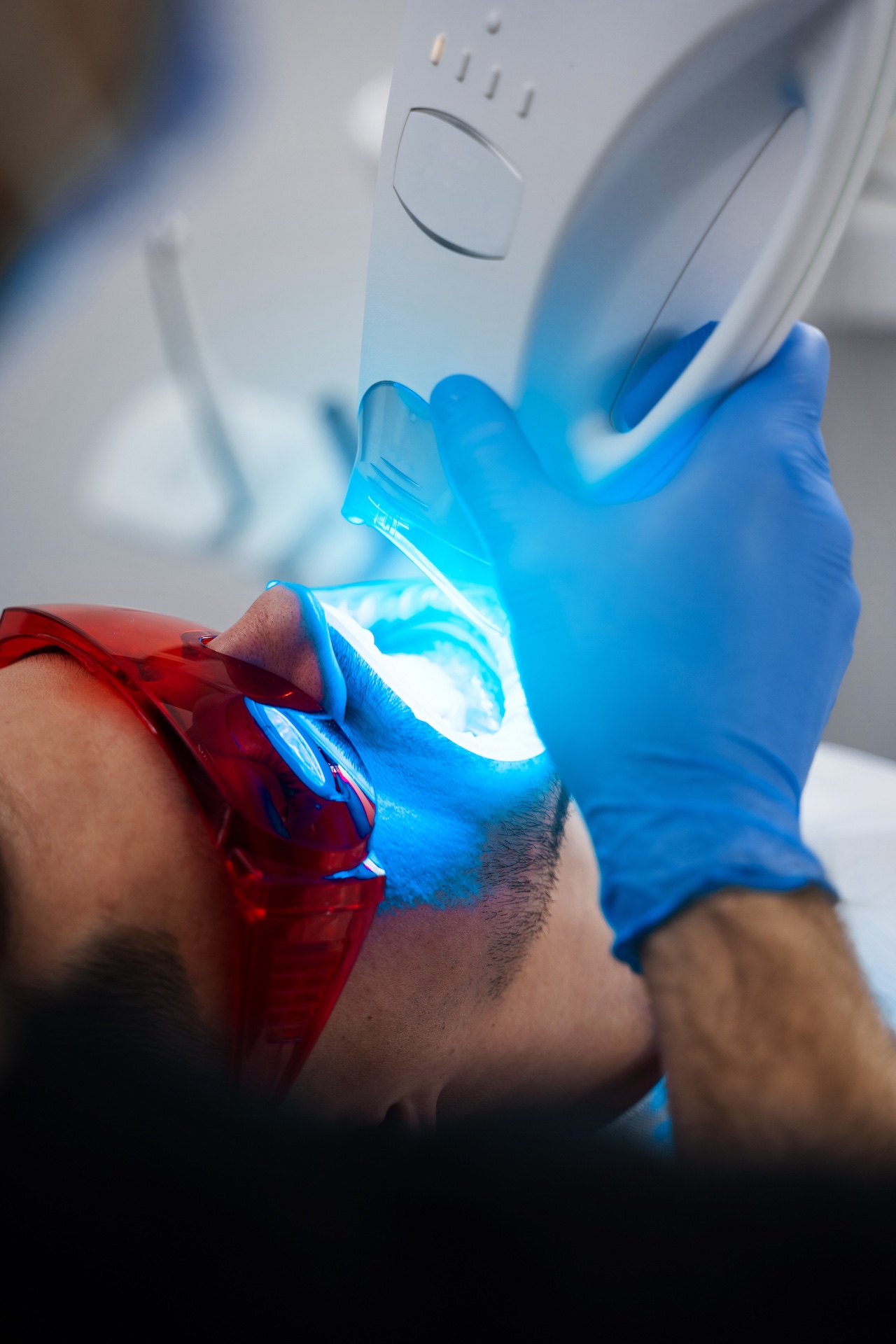 Dental whitening procedure by ultraviolet light. Patient whitens his teeth wearing goggles and lip retractor.