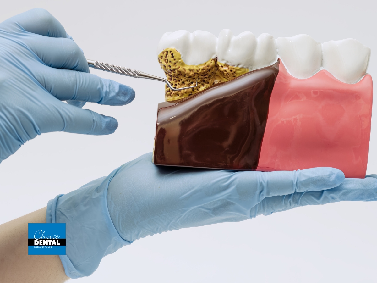 Periodontics vs General Dentistry: When Should You See a Periodontist?